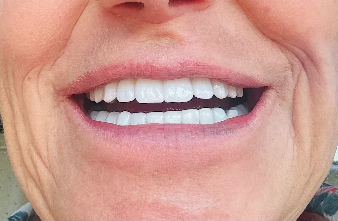 Αισθητική Οδοντιατρική | Smile Designers