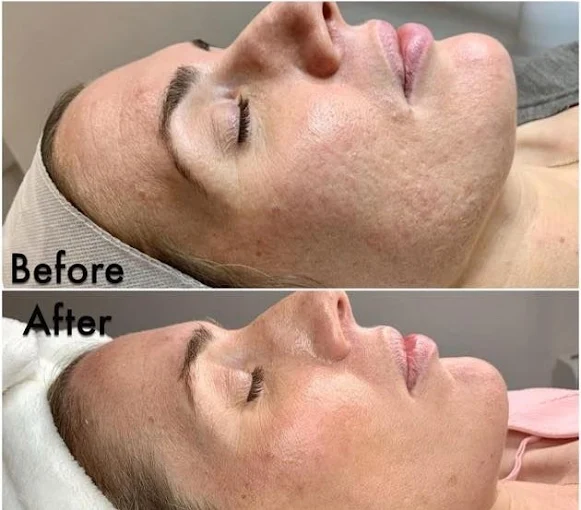 ΓΛΥΚΟΥ ΕΛΕΝΗ – ΚΕΝΤΡΟ ΑΙΣΘΗΤΙΚΗΣ ΑΘΗΝΑ